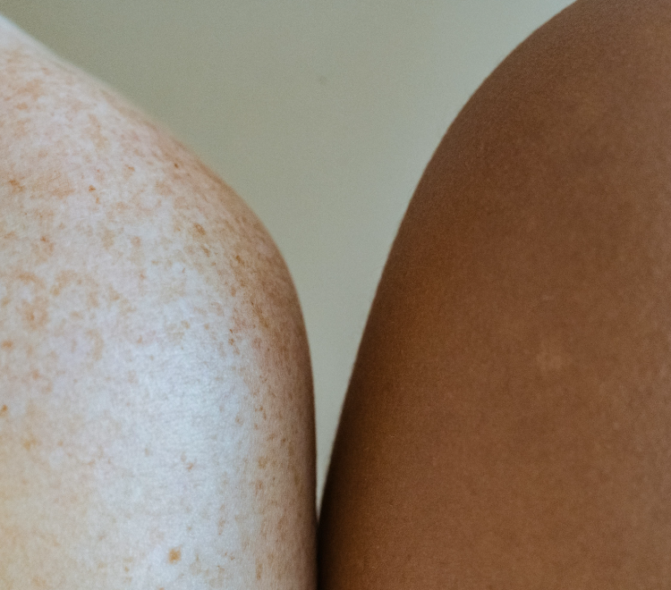 skin-cancer-service