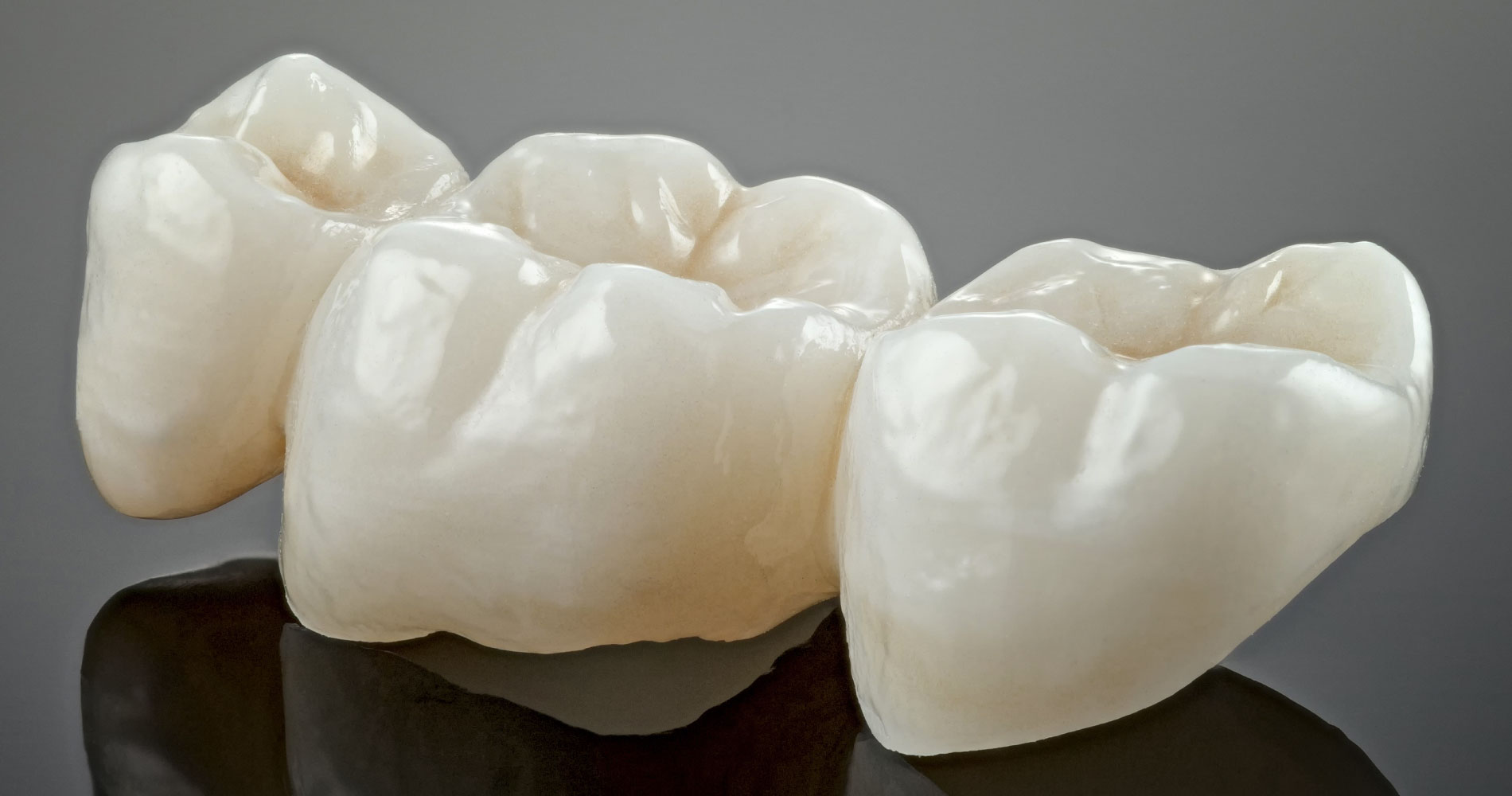 crowns-implants