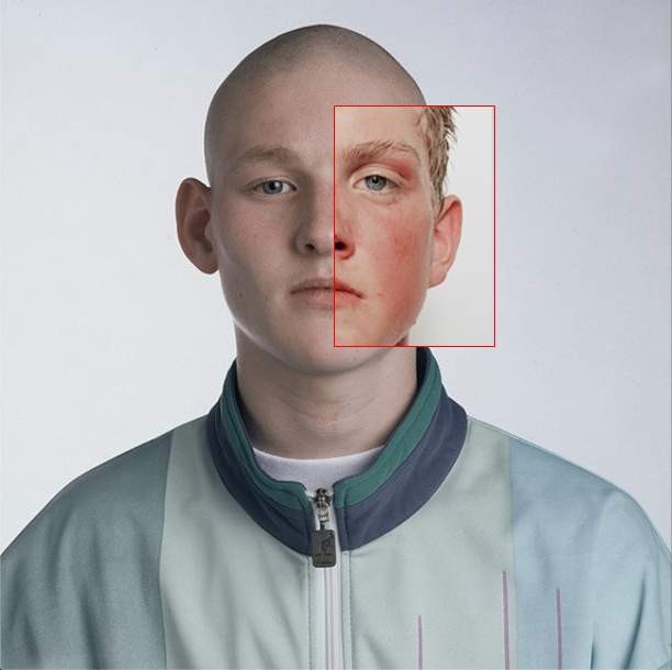 How to Lose Facial Fat Correctly 1